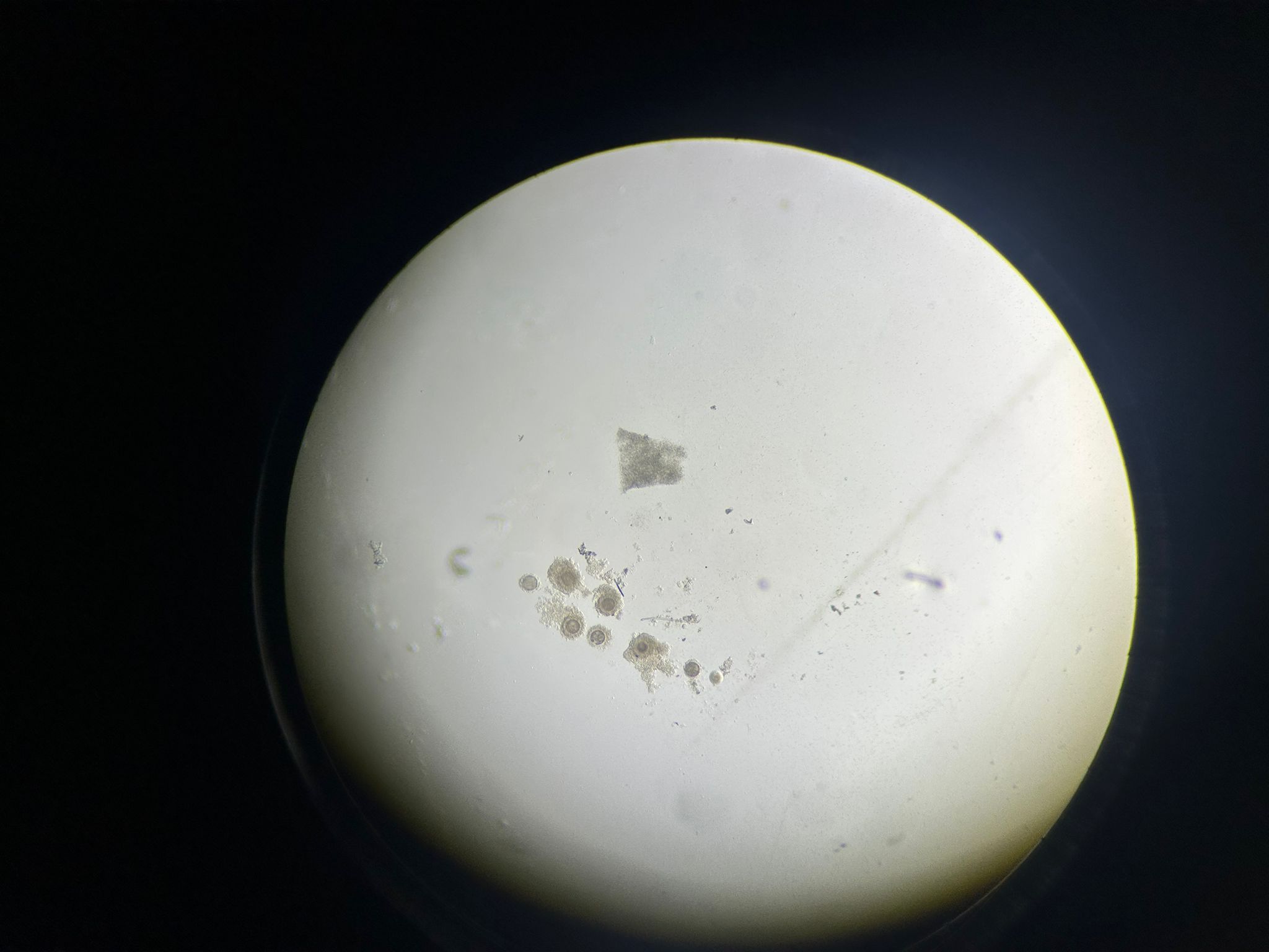 Ovocytes de vache récoltés après OPU